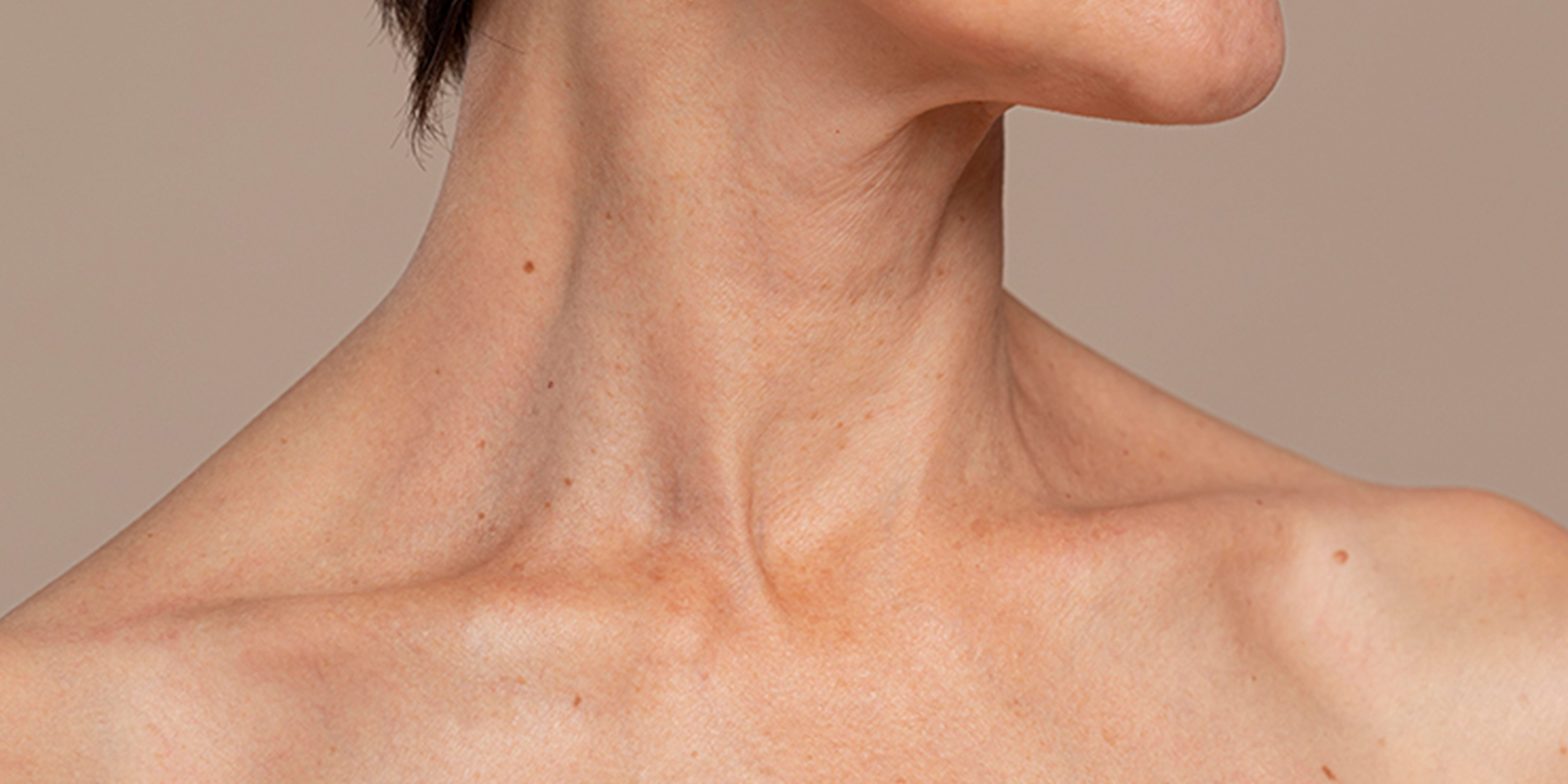 how to get rid of neck wrinkles